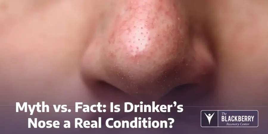 Myth vs. Fact: Is Drinker’s Nose a Real Condition?